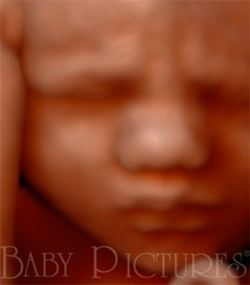 Baby Pictures Before Ultrasound Picture