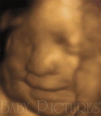 Baby Pictures Before Ultrasound Picture