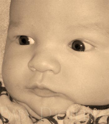 Baby Pictures After Ultrasound Picture