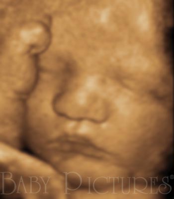 Baby Pictures Before Ultrasound Picture