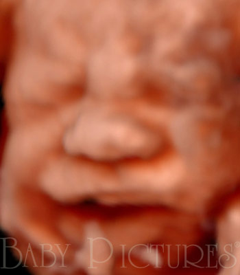 Baby Pictures Before Ultrasound Picture