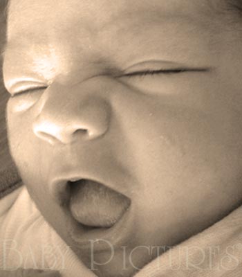 Baby Pictures After Ultrasound Picture