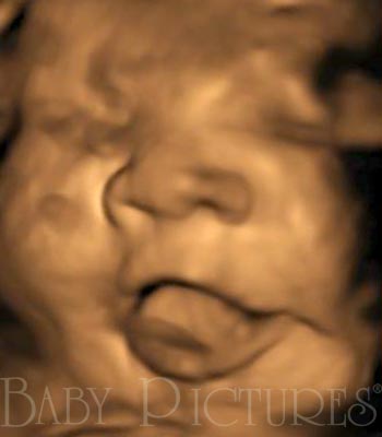 Baby Pictures Before Ultrasound Picture