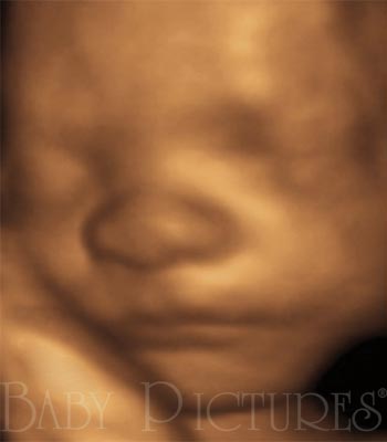 Baby Pictures Before Ultrasound Picture