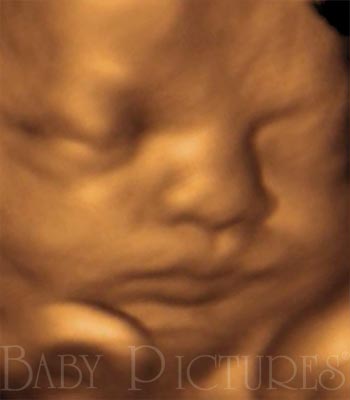 Baby Pictures Before Ultrasound Picture