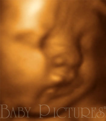 Baby Pictures Before Ultrasound Picture