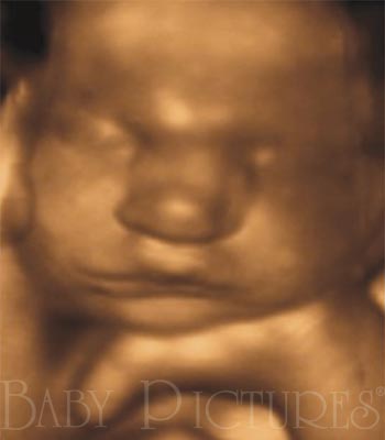Baby Pictures Before Ultrasound Picture