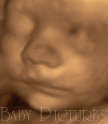 Baby Pictures Before Ultrasound Picture