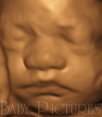 Baby Pictures Before Ultrasound Picture
