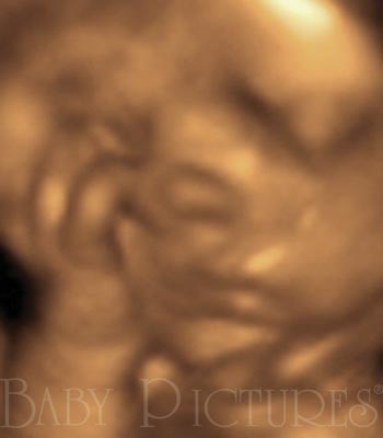 Baby Pictures Before Ultrasound Picture