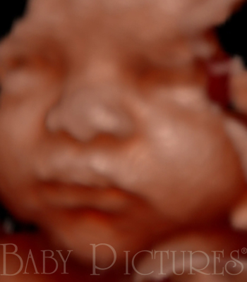 Baby Pictures Before Ultrasound Picture