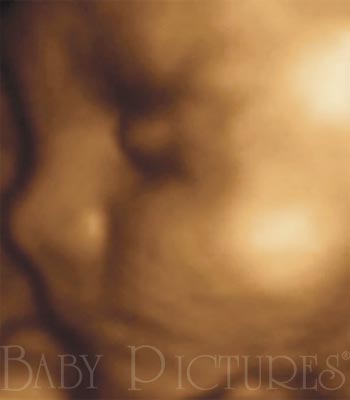 Baby Pictures Before Ultrasound Picture